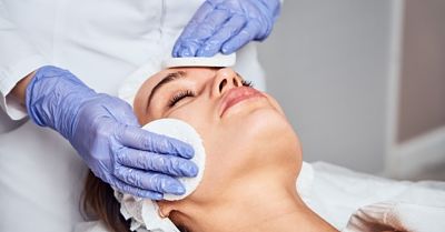 Skin peel_opt (1) Skin Peel Treatment
